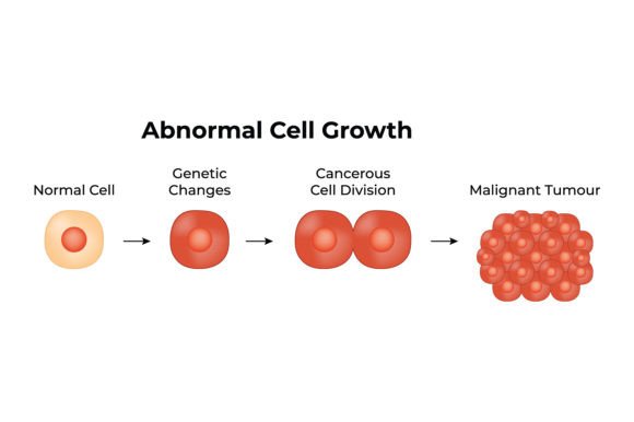 Download Abnormal Cell Growth Science Design - Design Collection